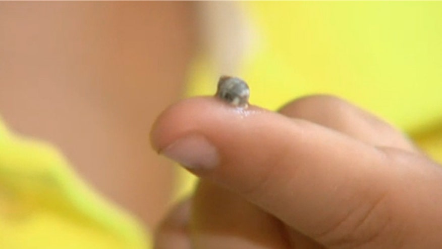 Sea Snail Knee Sky News.jpg